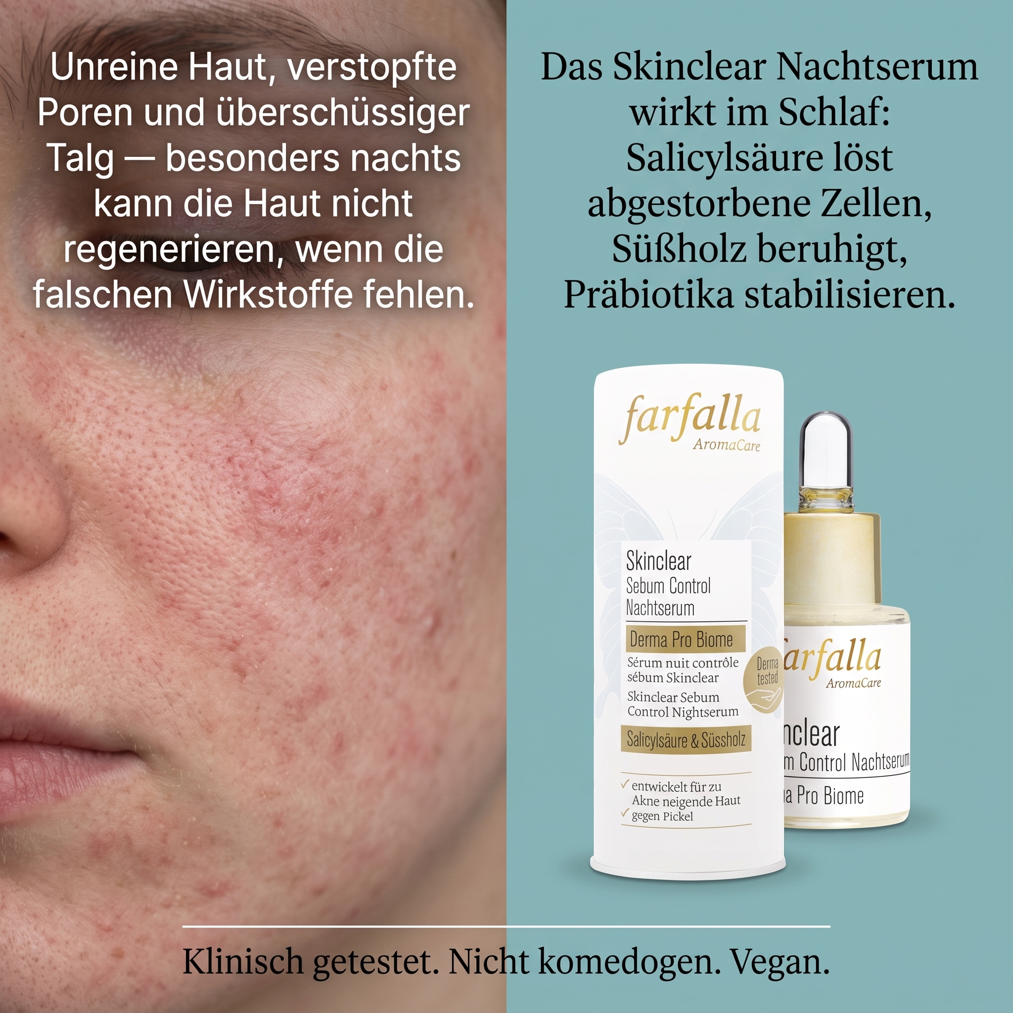 Skinclear Sebum Control Nachtserum Skinclear Sebum Control Nachtserum