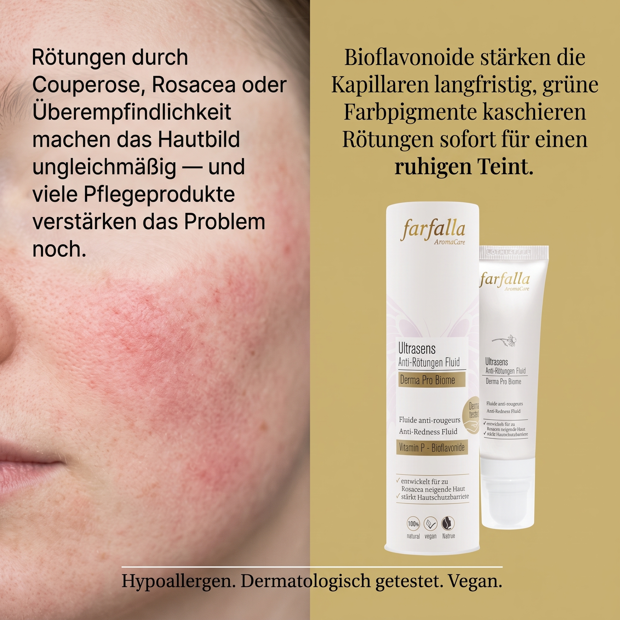 Ultrasens Anti-Rötungen Fluid Ultrasens Anti-Rötungen Fluid