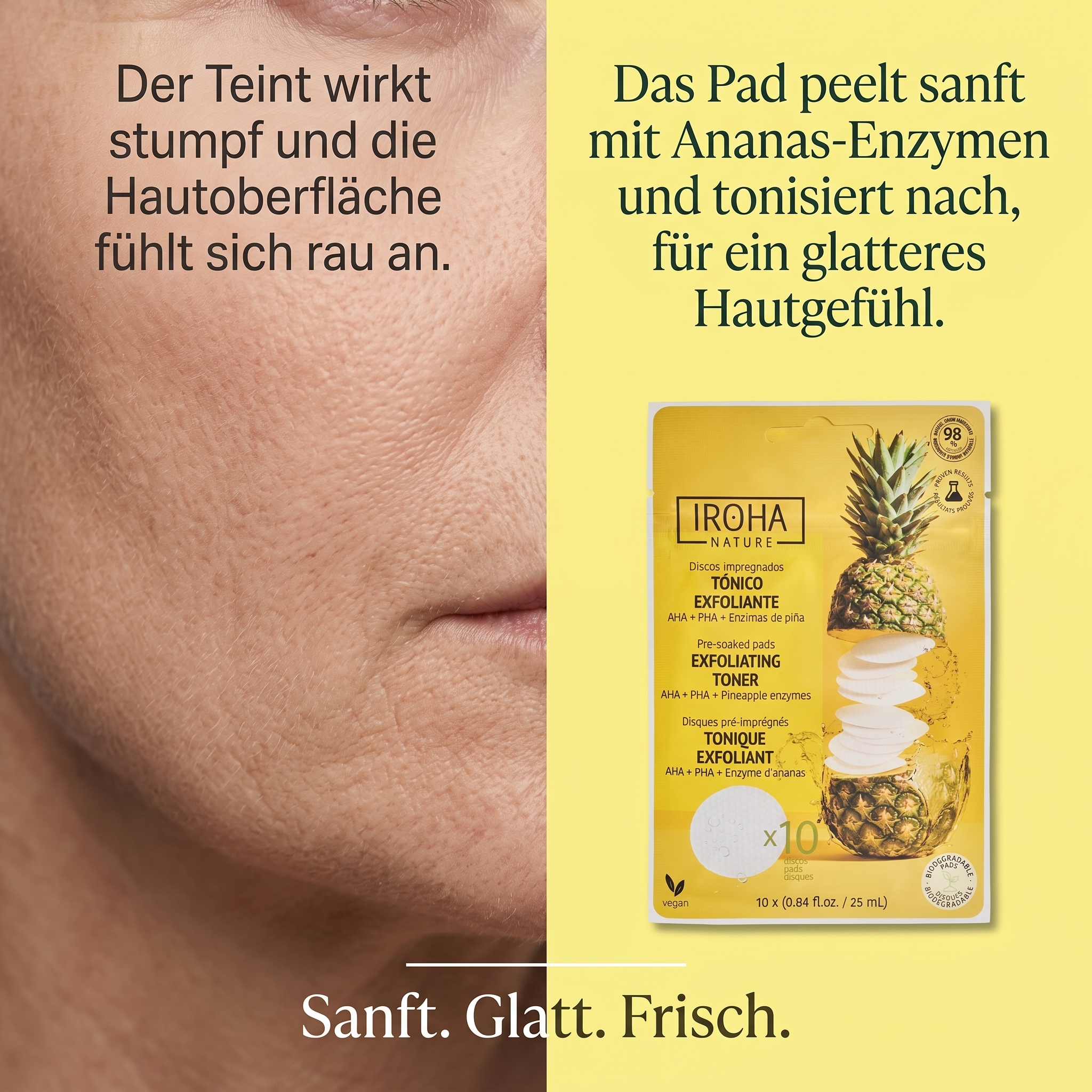 Ananas Exfoliating Toner Pad - NICHT MEHR LIEFERBAR - 