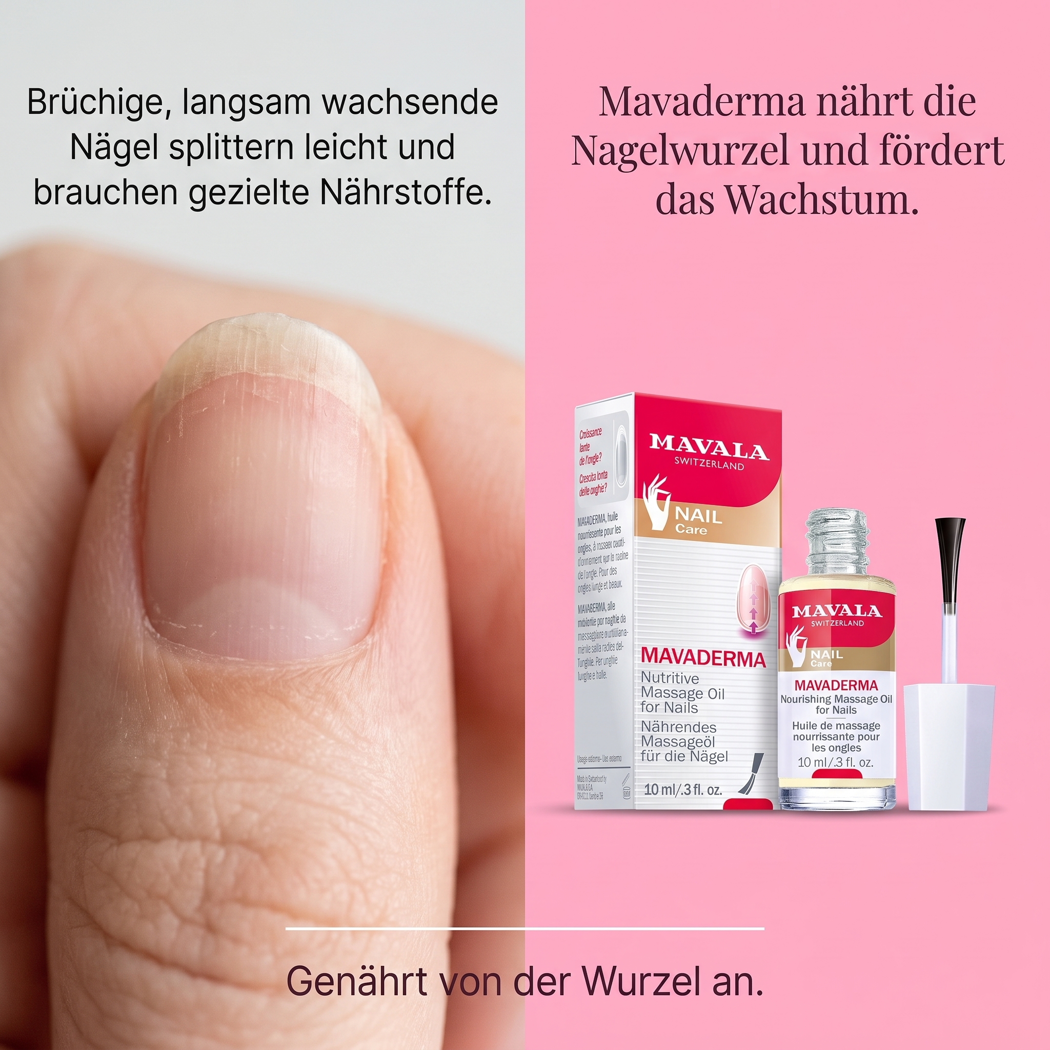 Mavaderma 