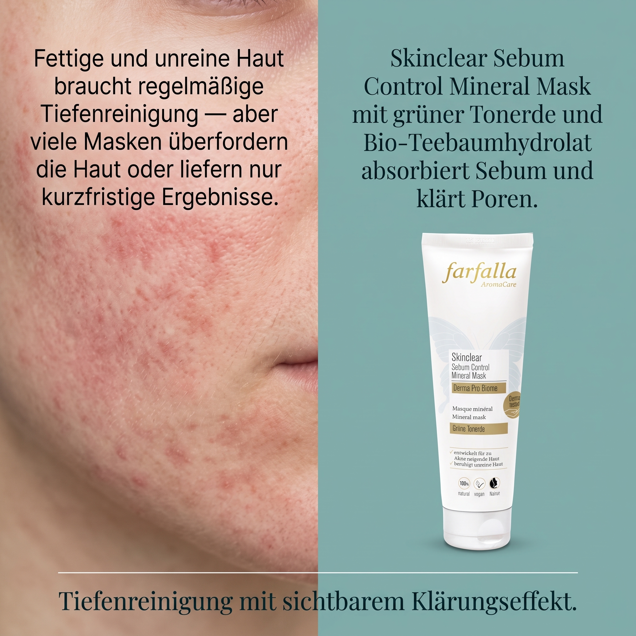 Skinclear Sebum Control Mineral Mask Skinclear Sebum Control Mineral Mask