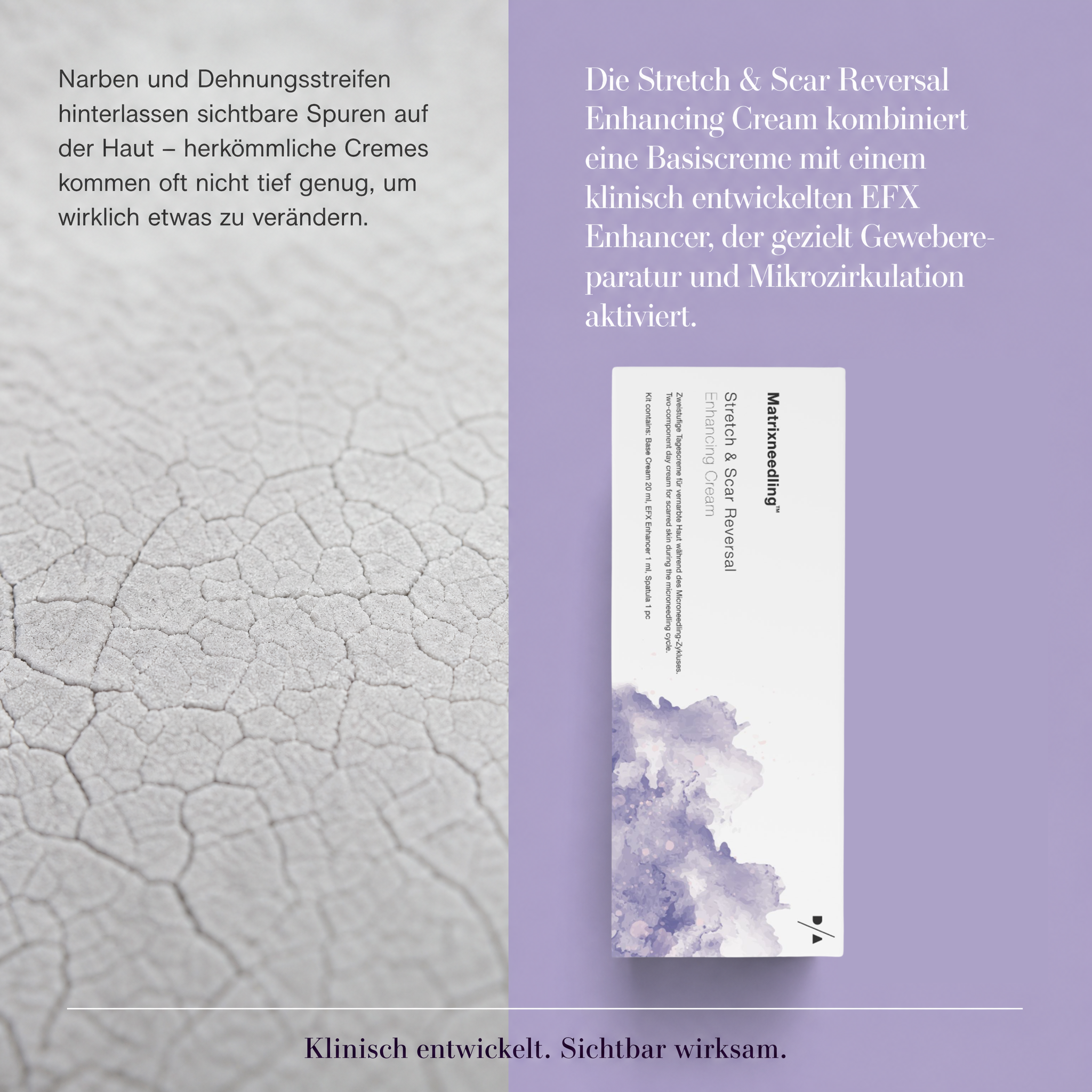 Stretch & Scar Reversal Enhancing Cream Stretch & Scar Reversal Enhancing Cream